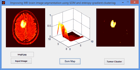 تصویر matlab_34_2 پروژه تقطیع تصویر MR با شبکه عصبی SOM و خوشه بندی آنتروپی گرادیان توسط MATLAB