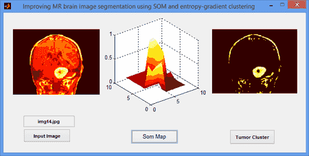 تصویر matlab_34_4 پروژه تقطیع تصویر MR با شبکه عصبی SOM و خوشه بندی آنتروپی گرادیان توسط MATLAB