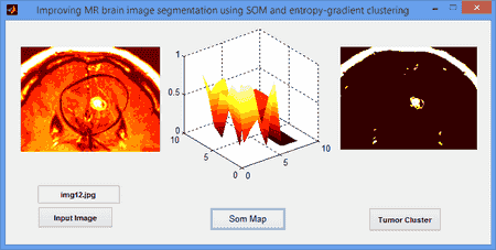 تصویر matlab_34_8 پروژه تقطیع تصویر MR با شبکه عصبی SOM و خوشه بندی آنتروپی گرادیان توسط MATLAB