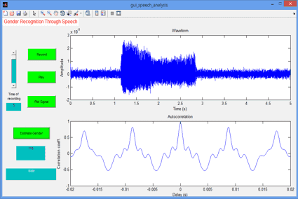 تصویر matlab_9132_2 تصویر matlab_9132_2 پروژه تشخیص صدای زن و مرد با نرم افزار MATLAB