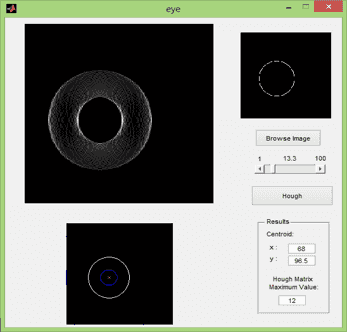 تصویر matlab_9757_1 تصویر matlab_9757_1 پروژه تشخیص عنبیه چشم با تبدیل هاف به کمک MATLAB