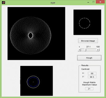 تصویر matlab_9757_2 تصویر matlab_9757_2 پروژه تشخیص عنبیه چشم با تبدیل هاف به کمک MATLAB