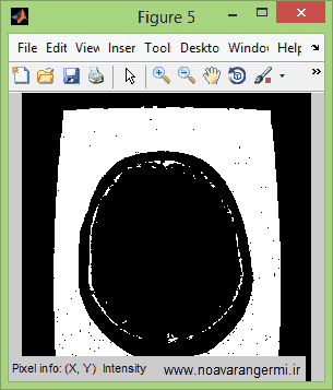 تصویر matlab-brain-tumotr-Fuzzy-logic-mamdani_11632_6 تصویر matlab-brain-tumotr-Fuzzy-logic-mamdani_11632_6 تشخیص تومور مغزی با منطق فازی و روش ممدانی با متلب