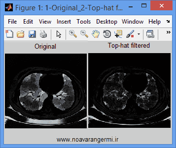 تصویر matlab-mathematical-morphology_11262_1 تصویر matlab-mathematical-morphology_11262_1 پردازش تصاویر پزشكی با مورفولوژی ریاضی با متلب