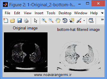 تصویر matlab-mathematical-morphology_11262_2 تصویر matlab-mathematical-morphology_11262_2 پردازش تصاویر پزشكی با مورفولوژی ریاضی با متلب