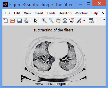 تصویر matlab-mathematical-morphology_11262_3 تصویر matlab-mathematical-morphology_11262_3 پردازش تصاویر پزشكی با مورفولوژی ریاضی با متلب