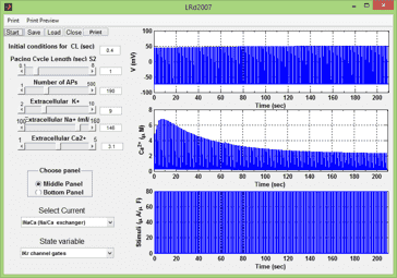 تصویر matlab-ecg_12229_2 تشخیص بیماری قلبی با سیگنال ECG با متلب MATLAB
