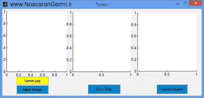 تصویر matlab-tumor-som_13678_1 تصویر matlab-tumor-som_13678_1 طبقه بندی تومور مغزی با شبكه عصبی SOM با متلب