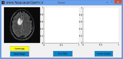 تصویر matlab-tumor-som_13678_2 تصویر matlab-tumor-som_13678_2 طبقه بندی تومور مغزی با شبكه عصبی SOM با متلب