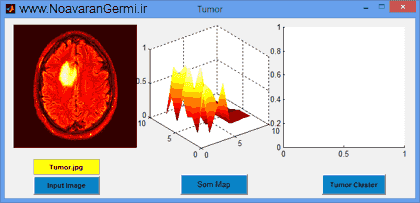 تصویر matlab-tumor-som_13678_3 تصویر matlab-tumor-som_13678_3 طبقه بندی تومور مغزی با شبكه عصبی SOM با متلب