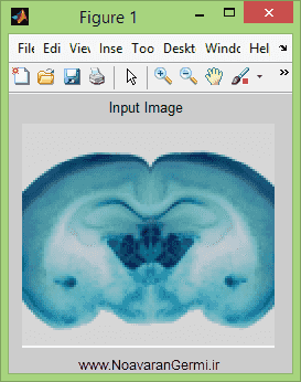 تصویر matlab-thyroid_13789_5 تصویر matlab-thyroid_13789_5 تشخیص غده تیروئید با پردازش تصویر با متلب