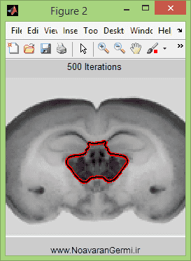 تصویر matlab-thyroid_13789_6 تصویر matlab-thyroid_13789_6 تشخیص غده تیروئید با پردازش تصویر با متلب