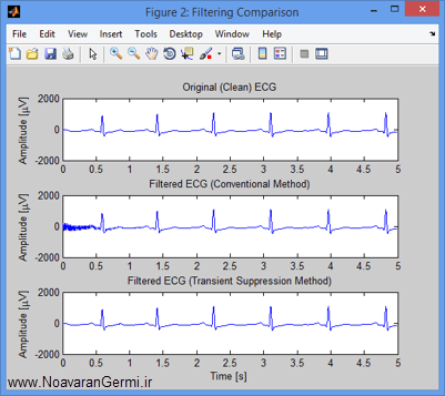 تصویر matlab-ecg_15297_2 تصویر matlab-ecg_15297_2 نظارت بر سیگنال ECG جنین برای اندازه گیری دقیق تپش قلب با متلب