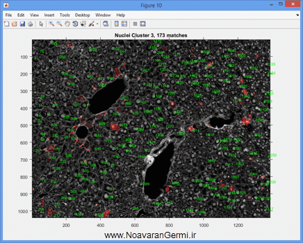 تصویر matlab-liver_19291_10 تصویر matlab-liver_19291_10 شناسایی و قطعه بندی بافت کبد از تصاویر میکروسکوپی به صورت خودکار در متلب