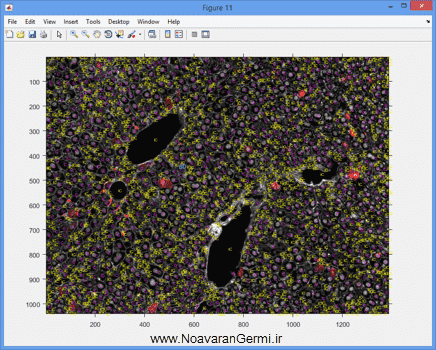 تصویر matlab-liver_19291_11 تصویر matlab-liver_19291_11 شناسایی و قطعه بندی بافت کبد از تصاویر میکروسکوپی به صورت خودکار در متلب
