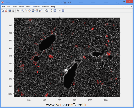 تصویر matlab-liver_19291_3 تصویر matlab-liver_19291_3 شناسایی و قطعه بندی بافت کبد از تصاویر میکروسکوپی به صورت خودکار در متلب