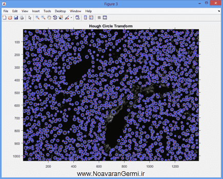 تصویر matlab-liver_19291_5 تصویر matlab-liver_19291_5 شناسایی و قطعه بندی بافت کبد از تصاویر میکروسکوپی به صورت خودکار در متلب