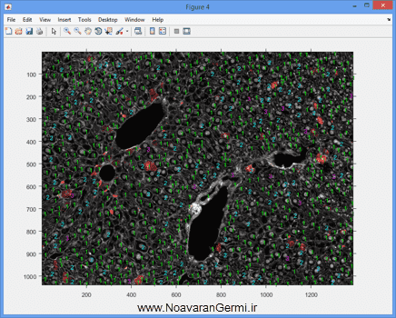 تصویر matlab-liver_19291_6 تصویر matlab-liver_19291_6 شناسایی و قطعه بندی بافت کبد از تصاویر میکروسکوپی به صورت خودکار در متلب