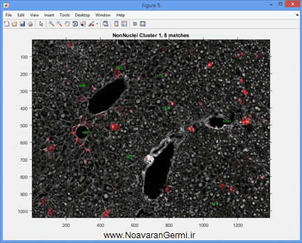تصویر matlab-liver_19291_7 تصویر matlab-liver_19291_7 شناسایی و قطعه بندی بافت کبد از تصاویر میکروسکوپی به صورت خودکار در متلب