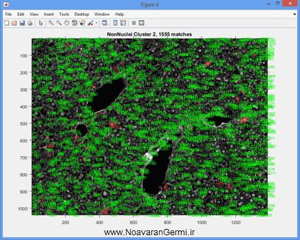 تصویر matlab-liver_19291_8 تصویر matlab-liver_19291_8 شناسایی و قطعه بندی بافت کبد از تصاویر میکروسکوپی به صورت خودکار در متلب