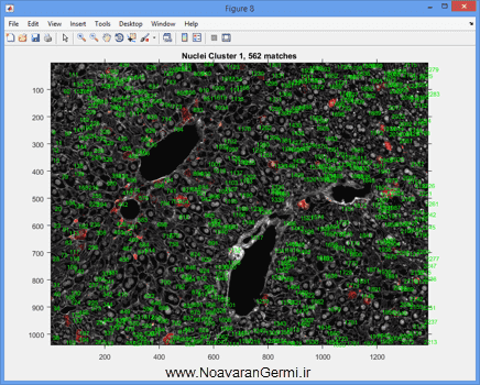 تصویر matlab-liver_19291_9 تصویر matlab-liver_19291_9 شناسایی و قطعه بندی بافت کبد از تصاویر میکروسکوپی به صورت خودکار در متلب