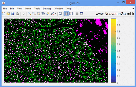 تصویر matlab-pathology_19099_10 تصویر matlab-pathology_19099_10 قطعه بندی سلول ها از تصاویر اسلاید طیف جهت آسیب شناسی دیجیتال با متلب