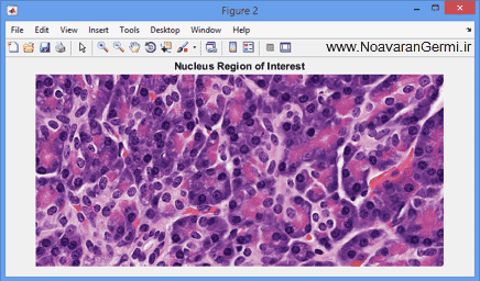 تصویر matlab-pathology_19099_2 تصویر matlab-pathology_19099_2 قطعه بندی سلول ها از تصاویر اسلاید طیف جهت آسیب شناسی دیجیتال با متلب