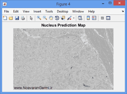 تصویر matlab-pathology_19099_3 تصویر matlab-pathology_19099_3 قطعه بندی سلول ها از تصاویر اسلاید طیف جهت آسیب شناسی دیجیتال با متلب