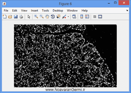 تصویر matlab-pathology_19099_4 تصویر matlab-pathology_19099_4 قطعه بندی سلول ها از تصاویر اسلاید طیف جهت آسیب شناسی دیجیتال با متلب