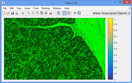 تصویر matlab-pathology_19099_6 تصویر matlab-pathology_19099_6 قطعه بندی سلول ها از تصاویر اسلاید طیف جهت آسیب شناسی دیجیتال با متلب