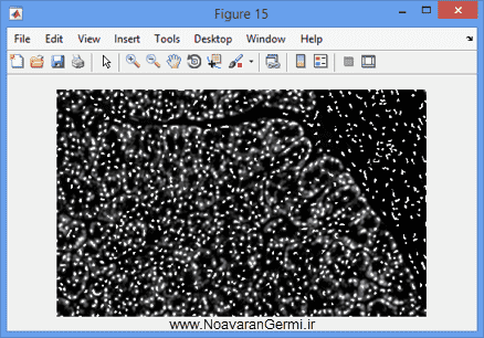 تصویر matlab-pathology_19099_7 تصویر matlab-pathology_19099_7 قطعه بندی سلول ها از تصاویر اسلاید طیف جهت آسیب شناسی دیجیتال با متلب