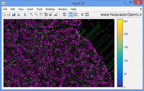 تصویر matlab-pathology_19099_9 تصویر matlab-pathology_19099_9 قطعه بندی سلول ها از تصاویر اسلاید طیف جهت آسیب شناسی دیجیتال با متلب