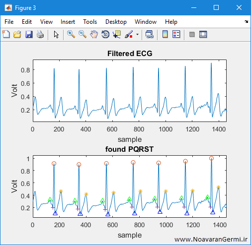 measurement rate rhythm heartbeat ecg 22439 matlab 10 تصویر