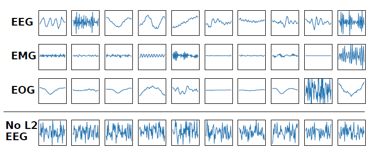 تصویر sleep-stage-classification-neural-networks-python_24026_3 تصویر sleep-stage-classification-neural-networks-python_24026_3 طبقه بندی خودکار مرحله خواب با شبکه عصبی عمیق CNN و LSTM در پایتون